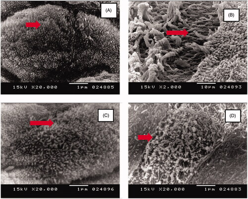 Figure 10. Scanning electron microscopic images of the rat nasal cilia treated with: (A) Normal Saline (negative control), (B) Isopropyl Alcohol (positive control) microemulsion, (C) Blank F1 (without ibuprofen), (D) Ibuprofen-loaded F1.