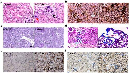 Figure 5. The effect of FADD phosphorylation on renal fibrosis in mice. A, H&E staining of mice kidney morphology. B, PASM staining. C, PAS staining. D, Masson staining. E-F, Immunohistochemical analysis of type IV collagen (E) and Ki67 (F). Scale bar 50 μm.