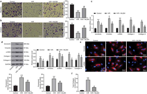 Figure 2. ML264 inhibits H/R-induced fibrosis of H9C2 cells. A-B, invasion and migration abilities of H9C2 cells determined by Transwell assays (one-way ANOVA** p < 0.01 vs. Control ## p < 0.01 vs. H/R treatment); C-D, mRNA (c) and protein (d) expression of fibronectin, Vimentin, α-SMA and Collagen I/II in cells determined by RT-qPCR and western blot analysis, respectively (two-way ANOVA, * p < 0.05, ** p < 0.01 vs. Control, # p < 0.05 vs. H/R treatment); E, Vimentin and α-SMA expression in cells further evaluated by immunofluorescence staining (one-way ANOVA, ** p < 0.01 vs. Control, ## p < 0.01 vs. H/R treatment); F, total collagen content in cells determined by a collagen kit (one-way ANOVA, ** p < 0.01 vs. Control, # p < 0.05 vs. H/R treatment). Data were exhibited as mean ± SD from at least three independent experiments