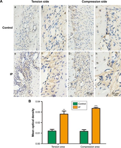 Figure 7 (A) Immunohistochemical staining of BMP-2. (a, c, e, g were captured in ×200, and b, d, f, h were captured in ×400. The expression of BMP-2 in the IP group was more than the control group. Bars indicate 20 µm. (B) Data analysis results of the immunohistochemical staining of BMP-2. **P<0.01, ***P<0.001.