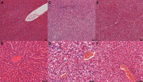 Figure 5 Effect of DPP4i treatment on liver steatosis. Sections were stained with hematoxylin&eosin. (A–B) histologic pattern of NC group (original magniﬁcation×100, ×200 respectively); (C–D) histologic pattern of NAFLD-C group (original magniﬁcation×100, ×200 respectively); (E–F) histologic pattern of NAFLD-T group (original magniﬁcation×100, ×200 respectively).