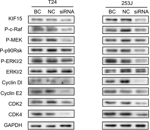 Figure 6 KIF15 promotes BC cells proliferation via the MEK–ERK pathway.Notes: Western blot analysis showed that KIF15 knockdown inhibited p-ERK, P-c-Raf, P-MEK, P-p90Rsk, CyclinD1, CyclinE2, CDK2, and CDK4 expression in BC cells. Adjustments of brightness, contrast, and size are applied to the whole images of western blot-based analyses without elimination of any information present in the original, including backgrounds.Abbreviations: BC, bladder cancer; NC, negative control.
