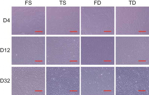 Figure 1. Cell morphology of FS, TS, FD, and TD. Phase contrast microscopic findings for FS, TS, FD, and TD from donor No. 4 at 4, 12, and 32 days after cell seeding. Scale bar indicates 100 μm.