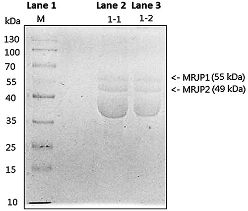 Figure 2. SDS-PAGE analysis of experimental RJ samples. Lane 1 (M) represents Molecular Protein Ladder (10–130 kDa). Lane 2 (1-1) represents RJ sample 1 and lane 3 (1-2) represents RJ sample 2.