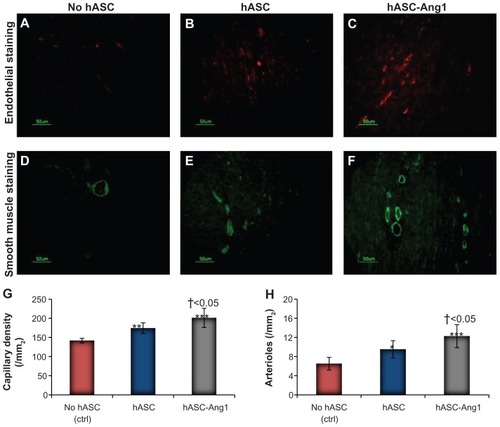 Figure 7 Angiogenesis and arteriogenesis in the periinfarct area. Immunohistological staining of CD31 to detect endothelial cells in (A) no hASC, (B) hASC, and (C) hASC-Ang1 groups. Immunohistological staining of smooth muscle α-actin for smooth muscle cells in (D) no hASC, (E) hASC, and (F) hASC-Ang1 groups. Quantification of (G) capillary and (H) arteriole density.Notes: Data are expressed as mean ± standard deviation. One-way analysis of variance: (G) F = 24.86, P < 0.0001 and (H) F = 18.48, P < 0.0001 (treatment groups). Statistically significant differences between groups compared to control no hASC are indicated as ***P < 0.001; **P < 0.01; *P < 0.05. Significant difference between hASC and hASC-Ang1 is indicated by †.Abbreviations: hASC, human adipose tissue-derived cell; hASC-Ang1, angiopoietin-1-expressing human adipose tissue-derived cell; ctrl, control.