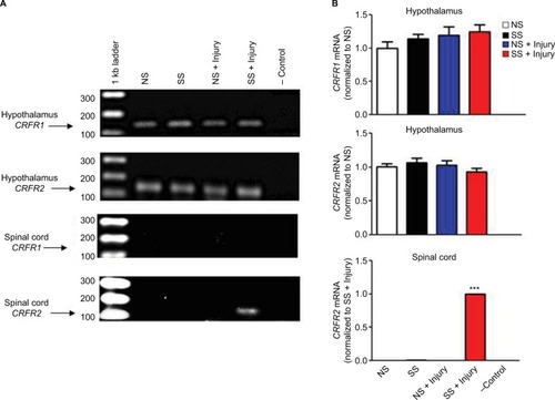 Figure 6 SS upregulates CRFR2 mRNA expression levels in the lumbar section of the spinal cord of thermally injured rats.