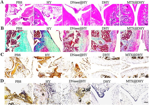 Figure 6. The combined anti-inflammatory effects of DHY and MTX on the RA model. (A-B) H&E (A) and safranin O/fast green (B) staining of the knee joint tissue. (C-D) IHC staining of tumor necrosis factor-α (C) and interleukin-6 (D). Scale bar, 100 μm.