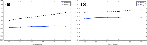 Figure 7. Relative L2 errors of the reconstructed current density images in the chosen slice near the centre of the imaging object: low contrast case. (a) and (b) are the plots for the horizontal and vertical current injections, respectively.