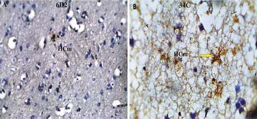 Figure 9. Photomicrograph of Cattle egret (Bublucus ibis) hippocampus immunoreaction stain (a) reveals the low reaction with agrin proteoglycan in the medial hippocampus (HCm); (b) the density reaction level of the ryanodine receptor. Bar: A-B = 100 µm