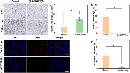 Figure 9 Immunohistochemical staining of (A) CD31 and (B) tumor necrosis factor (TNF)-α. Quantification of (C) blood vessels and (D) inflammatory area based on CD31 and TNF-α staining, respectively. Scale bar: 200 μm. (E) Immunofluorescence staining and (F) quantification percentage of CD68 cells on day 12. Scale bar: 50 μm. *p < 0.05.