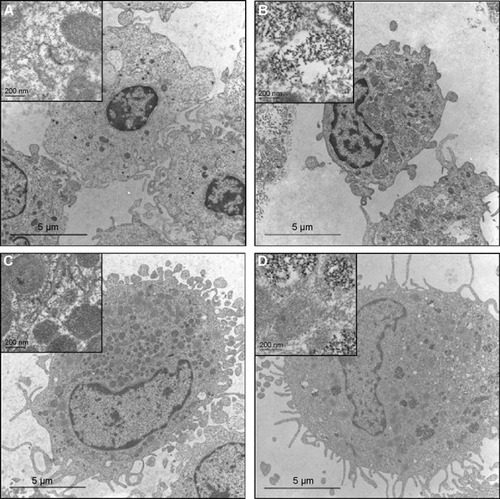 Figure 5 Transmission electron microscopy (TEM) of human monocytes and monocyte-derived macrophages (MDMs) incubated with a-PVA-SPION.Notes: Human monocytes were incubated for 24 hours without (A) or with (B) a-PVA-SPION (1,000 μg/mL). (C, D) Human MDMs were incubated for 24 hours without (C) or with (D) a-PVA-SPION (1,000 μg/mL). Both cell types showed uptake of SPION in phagosomes; some are scattered but others were tightly filled with nanoparticles (scale indicated on the figure).Abbreviation: a-PVA-SPION, amino-polyvinyl alcohol coated superparamagnetic iron oxide nanoparticles.