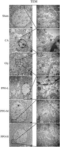 Figure 3. TEM of the rat cerebral cortex at 24 h after CA/CPR. Neuronal cells showing necroptosis, organelle swelling, mitochondrial crest rupture or loss, and plasma membrane discontinuation. Scale bar in the left panels: 1 μm; scale bar in the right panels: 200 nm. CA: cardiac arrest/0.9% saline group; CPR: cardiopulmonary resuscitation.
