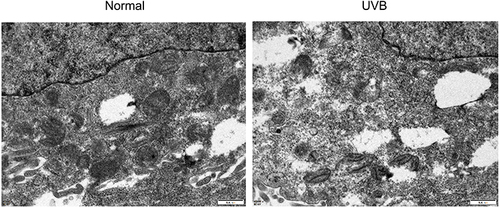 Figure 3 The mitochondrial morphology of HaCaT in two groups was detected by transmission electron microscope (×10.0K).