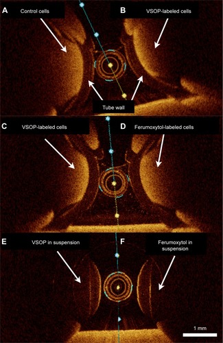 Figure 4 OCT images of iron oxide NP-labeled macrophages.Notes: Unlabeled RAW 264.7 cell phantoms (A), labeled with VSOP at concentration 2 (12±1.5 pg Fe/cell) (B), labeled with VSOP at concentration 1 (7.1±1.5 pg Fe/cell) (C) and labeled with ferumoxytol (6.6±2 pg Fe/cell) (D). In comparison to the unlabeled cells, NP labeling increased the OCT signal of macrophages and induced stronger attenuation. In contrast, VSOP (E) and ferumoxytol (F) in suspension (no cells) with slightly higher NP concentrations than the cell phantoms did not generate visible OCT signals, which is in accordance to the spectroscopy measurements (Figure 3).Abbreviations: NP, nanoparticle; OCT, optical coherence tomography; VSOP, very small iron oxide particles.