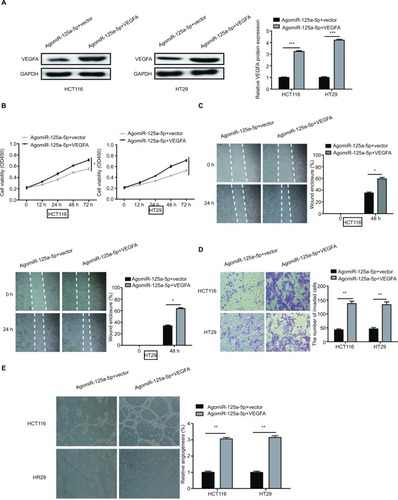 Figure 5 VEGFA overexpression could reverse the inhibitory effects of miR-125a-5p in CRC. (A) VEGFA protein expression in HCT116 and HT29 cells was measured after agomiR-125a-5p and VEGFA expression plasmid or blank (vector) transfection. (B–E) Cell proliferation, migration, invasion, and angiogenesis were measured in the HCT116 and HT29 cells transfected with agomiR-125a-5p and VEGFA expression plasmid or blank vector. *P<0.05, **P<0.01.Abbreviation: CRC, colorectal cancer.