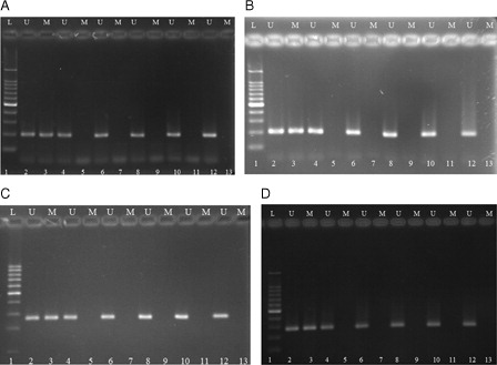 Figure 7. Methylation-specific PCR of bisulfite-modified DNA using primer pairs specific for methylated and unmethylated p21 and p57 genes' promoter sequence. (A, B) representing p21 MSP results and (C, D) representing p57 MSP results for expanded cells in cytokine liquid culture and in co-culture system with cytokine, respectively. M, primers specific for methylated DNA; U, primers specific for unmethylated DNA. 1, DNA ladder; 2, unmethylated DNA control; 3, methylated DNA control; 4, 6, 8, 10, and 12 illustrate DNA amplification at days 0, 3, 7, 10, and 14 of culture, respectively, with unmethylated primers; 5, 7, 9, 11, and 13 had no band indicating lack of DNA amplification for expanded cells at days 0, 3, 7, 10, and 14 of culture, respectively, with methylated primers.