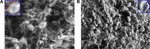 Figure 7 SEM images of the action of the nanoparticles of IQCA-TAVV on rat platelets.Notes: (A) SEM images of AA-activated rat platelets treated with normal saline, in which an amplified platelet having a smooth surface is inserted and the extended pseudopodia are labeled with red arrowheads; (B) SEM images of AA-activated rat platelets treated with 200 nM IQCA-TAVV, in which an amplified platelet without pseudopodia and the nanoparticles of IQCA-TAVV on the surface are labeled with blue arrowheads.Abbreviations: SEM, scanning electron microscopy; AA, arachidonic acid; IQCA-TAVV, N-(3S-1,2,3,4-tetrahydroisoquinoline-3-carbonyl)-Thr-Ala-Arg-Gly-Asp(Val)-Val.