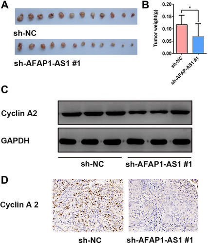 Figure 6 Knockdown of AFAP1-AS1 inhibited tumor growth and suppressed the expression of CCNA2 in vivo. (A and B) Tumor xenografts in the sh-AFAP1-AS1#1 group were significantly smaller than those in the sh-NC group. (C) Protein expression levels of cyclin A2 were determined by Western blotting of xenograft samples. (D) Representative IHC staining of cyclin A2 proteins in OSCC xenograft specimens. (×400). *P<0.05.