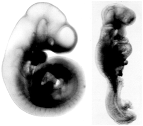 Figure 1. Two day-9 rat embryos from a normal (left embryo) and a diabetic (right embryo) pregnancy. The latter embryo is growth-retarded (reduced crown-rump length and somite number) and malformed (rotational defect, open neural tube).