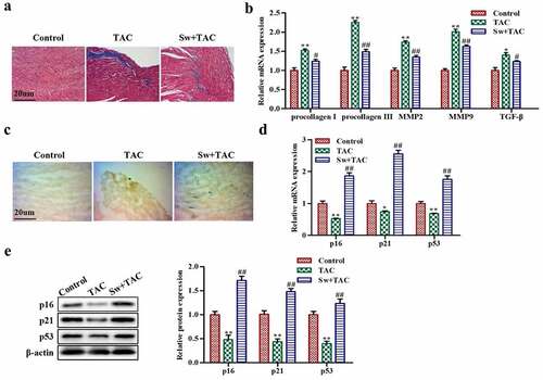 Figure 2. Exercise-induced myocardial hypertrophy preconditioning inhibits myocardial fibrosis by promoting premature senescence of fibroblasts in vivo.