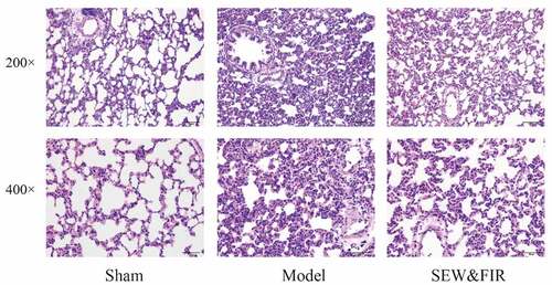 Figure 6. Lung tissues subjected to HE staining and observed under a light microscope at 200× and 400× magnifications. Representative images of each group are shown at scale bars of 100 μm and 50 μm. Sham indicates the sham group, model as the ARDS rat model control, and special electromagnetic field-treated water (SEW) and far-infrared radiation (FIR) as the SEW and FIR group