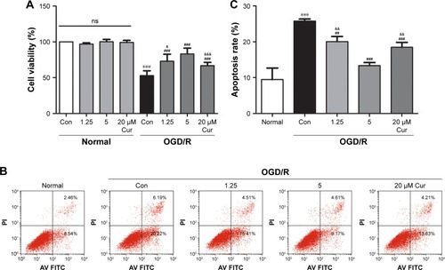 Figure 1 Curcumin protects PC12 cells against OGD/R injury.