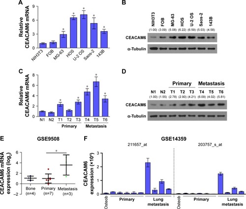 Figure 1 CEACAM6 is overexpressed in metastatic osteosarcoma.