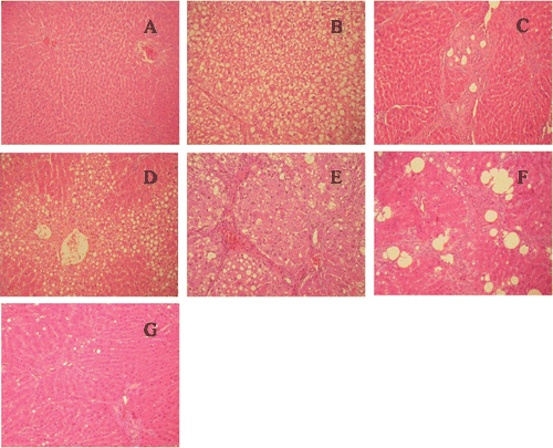 Figure 2.  Light microscopic analysis (HE stain, × 200) of rat liver sections of normal rats and CCl4 treatment with or without DHZCP administration. (A) normal group; (B) CCl4-induced (M) group at the end of week 8; (C) high- dose of DHZCP at the end of week 8; (D) low- dose of DHZCP at the end of week 8; (E) CCl4-induced (M) group at the end of week 12; (F) high- dose of DHZCP at the end of week 12; (G) low-dose of DHZCP at the end of week 8.