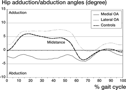 Figure 9. Mean value of hip or relative femoral adduction/abduction angles related to a standardized gait cycle in women with medial or lateral OA and in the controls (normal). Data represent mean values based on division of the gait cycle into 200 intervals for each patient, independent of the individual time period for each cycle. In the figures the mean value for each of the 3 groups (n = 3 x 15) at each time interval is presented. Thus, each curve is based on 200 subsequent mean values. No further filtering of data was done.