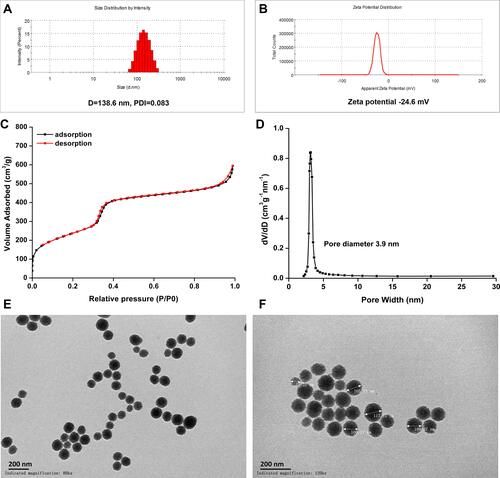 Figure 2 Characterization of mesoporous silica nanoparticles. (A) Size distribution and (B) zeta potential of MSNs; (C) N2 adsorption/desorption isotherm curves and (D) pore diameter; TEM image of MSNs, (E) and (F) at magnifications of 80k × and 120k ×, respectively. Bar = 200 nm.