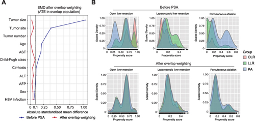 Figure 2 Assessment of balance of overlap weighting analysis. (A) The absolute SMDs of potential confounders before and after overlap weighting analysis. (B) Density plot of generalized propensity score in OLR, LLR and PA groups before and after overlap weighting analysis.