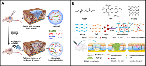 Figure 4 (A) Carboxymethyl chitosan (CMC) combined with dialdehyde-modified cellulose nanocrystal (DACNC) nanocomposite hydrogel for irregular and deep burn wounds. Reproduced with permission from: Huang W, Wang Y, Huang Z, et al. On-demand dissolvable self-healing hydrogel based on carboxymethyl chitosan and cellulose nanocrystal for deep partial thickness burn wound healing. ACS Appl Mater Interfaces. 2018;10(48):41076–41088. doi:10.1021/acsami.8b14526.Citation142 Copyright © 2018, American Chemical Society. (B) Synthesis of bioactive silica-based nanocomposite (PABC) hydrogel scaffold and its potential application and hypothetical mechanism in diabetic wound healing. Reproduced with permission from: Li Y, Xu T, Tu Z, et al. Bioactive antibacterial silica-based nanocomposites hydrogel scaffolds with high angiogenesis for promoting diabetic wound healing and skin repair. Theranostics. 2020;10(11):4929–4943. doi:10.7150/thno.41839.Citation146 Copyright © The author(s). Creative commons attribution license (https://creativecommons.org/licenses/by/4.0/).