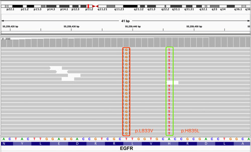 Figure 1 Identification of L833V and H835L in EGFR exon 21 from liquid biopsy.