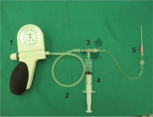 Figure 2 Vascular anastomotic break pressure-measuring instrument.