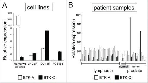 Figure 1. BTK expression in prostate cell lines and tumors. BTK-C message is more abundant than the BTK-A isoform in prostate cancer cells and tumors. cDNA prepared from RNA isolated from prostate cancer cell lines (A) and human prostate normal and tumor tissues. (B) was subjected to qPCR using primers specific for BTK-A and BTK-C isoforms. Expression of each isoform was normalized to an actin control in the respective qPCR reaction. The data represent relative mRNA levels of each BTK isoform as fold increase of the normal tissue sample with the lowest expression. Lymphoma samples are shown for comparison. BTK-C was the predominant isoform in only 3% of lymphomas but 40% of prostate tumors (6 out of 15 cases).