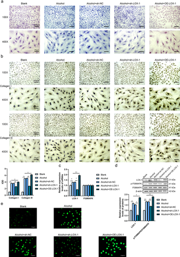 Figure 1. Knockdown of LOX-1 ameliorates myocardial fibrosis in alcohol-treated rats’ cardiac fibroblasts. (a) Collagen deposition in 5 groups of rats’ cardiac fibroblasts was shown by Masson staining under 100X and 400X magnification. Scale bars: 100 μm and 25 μm. (b) The levels of collagen I and III were detected using IHC under 100X and 400X magnification. Scale bars: 100 μm and 25 μm. (c) The relative expression levels of mRNAs in cardiac fibroblasts were analyzed by RT-qPCR. (d) The relative expression levels and phosphorylation levels of proteins in cardiac fibroblasts were assessed by western blot. (e) The ROS level was detected using DCFH-DA assay. Scale bars: 40 μm.*: P < 0.05 and **: P < 0.01.