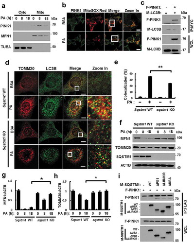 Figure 9. PINK1 interacts with SQSTM1 and LC3B. (a) Mitochondrial fractionation analysis was performed using Hepa1c1c7 cells after treatment with PA (500 μM) for the indicated times, and samples were subjected to immunoblot analysis using antibodies specific for PINK1, MFN1, and TUBA (loading control). (b) Confocal microscopy analysis of MitoRED and PINK1 staining in Hepa1c1c7 cells after treatment with PA (500 μM) for 18 h. Nuclei were also stained with DAPI, and representative single optical sections and merge images are shown. Scale bars: 10 μm. (c) Lysates of HEK293 cells transfected with vectors encoding FLAG-PINK1 and MYC-LC3B were subjected to immunoprecipitation with MYC antibodies, and the resulting precipitates (IPs), as well as whole cell lysates (WCLs), were subjected to immunoblot analysis with antibodies specific for the indicated proteins. (d) Confocal microscopy analysis of colocalization of TOMM20 and LC3B in Sqstm1 WT or sqstm1 KO MEF cells after treatment with PA (500 μM) for 18 h. (e) Quantitative analysis of colocalization of TOMM20 and LC3B. Scale bars: 5 μm. (f) Immunoblot analysis of MFN1, TOMM20, SQSTM1, and ACTB (loading control) in Sqstm1 WT or sqstm1 KO MEF cells after treatment with PA (500 μM) for the indicated times. Densitometric analysis of MFN1 (g) and TOMM20 (h) immunoblots were also performed. (i) Lysates of HEK293 cells transfected with deletion constructs of M-SQSTM1 and F-PINK1 were subjected to immunoprecipitation with FLAG antibodies, and the resulting IPs and WCLs were subjected to immunoblot analysis using antibodies specific for the indicated proteins. Data are shown as mean ± SD from 3 independent experiments. *p < 0.05 and **p < 0.01.