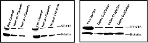 FIGURE 5  NFAT5 protein in the human and ovine placenta. NFAT5 protein was detected in the protein lysates from human and ovine cotyledon placenta.