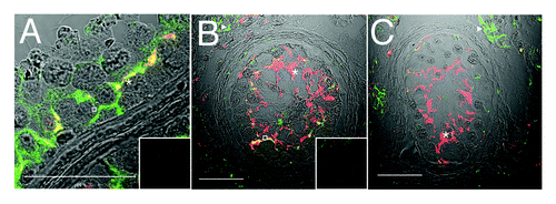 Figure 3. Claudin-11 and Connexin 43 are disorganized in testicular dysgenesis. Confocal immunofluorescence of normal (A) and carcinoma in situ (B and C) human testis sections detecting claudin-11 (red, tight junctions, asterisks) and connexin 43 (green, gap junctions, open squares and triangles). Co-localization appears in yellow. Inserts are negative controls. (Bar = 50 µm).