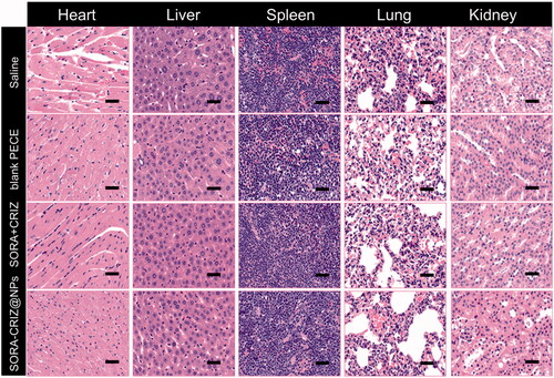 Figure 10. H&E staining of various organs of 4T1 tumor-bearing mice treated with saline, blank PECE, SORA + CRIZ, and SORA–CRIZ@NPs. The scale bar = 50 µm.