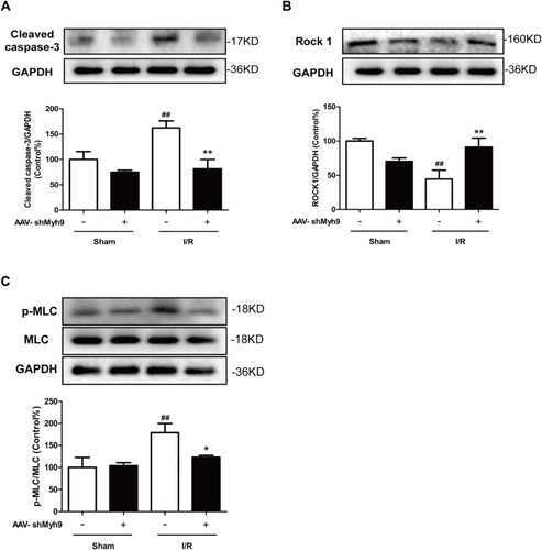 Figure 6 NMMHC IIA inhibition attenuates I/R-induced Caspase 3/ROCK/MLC pathway activation. Mice in each group were sacriﬁced 24 hrs after the MCAO/R. Tissue lysates were then subjected to Western blotting assay. Protein expression of cleaved-caspase 3 (A), ROCK1 (B) and phosphorylated MLC/MLC (C) were measured using relevant antibodies. All data are presented as the mean±SD of 3 independent experiments. ##P<0.01 vs sham group; *P<0.01 and **P<0.01 vs I/R group.