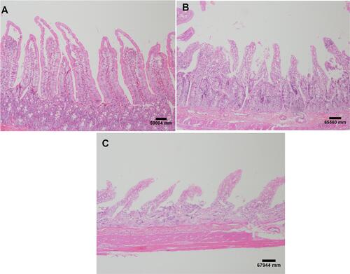 Figure 7 Small intestine histological evaluation. Images referring to the control group without injury (A); moderate injuries (B) and severe lesions (C) in the intervention group. H&E staining and both at 40X magnification. Each experimental group with 10 male Sprague Dawley rats.