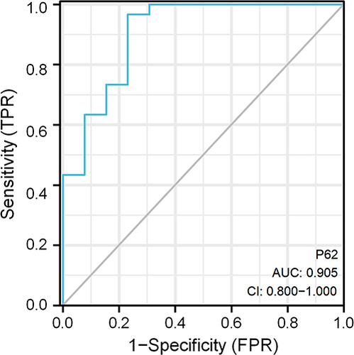 Figure 4 ROC curve analysis of glomerular P62 protein in DKD patients.