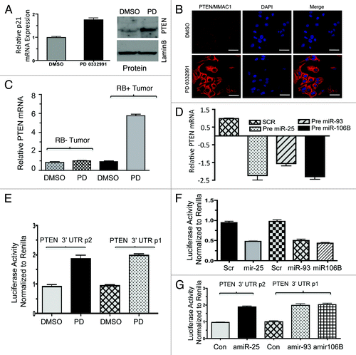 Figure 6. Analysis of PTEN regulation in in vitro and ex vivo breast cancer models in response to miR106b-cluster and PD 0332991. (A) qRT-PCR analysis of PTEN mRNA (left panel) and immunoblot (right panel). (B) Immunolocalization of PTEN protein in MCF7 cells. (C) qRT-PCR analysis of PTEN mRNA in RB+ and RB- human solid tumors in response to CDK4/6 inhibitors. (D) qRT-PCR analysis of PTEN mRNA in response to ectopic expression of precursor mirR 25, 93 and 106b in MCF7 cells. (E) PTEN 3′ luciferase activity in MCF7 cells in response to PD 0332991 and signals were normalized to renilla luciferase. (F) PTEN 3′ luciferase activity in MCF7 cells in response to ectopic expression of precursor mirR 25, 93 and 106b, and signals were normalized to renilla luciferase. (G) PTEN 3′ luciferase activity in MCF7 cells in response to ectopic expression of anti-mirR 25, 93 and 106b, and signals were normalized to renilla luciferase. Each data point is a mean ± SD from three or more independent experiments. (tumors n = 11 ER+RB+ tumors and 2 ER-RB- tumors.) p < 0.05 were considered as significant.