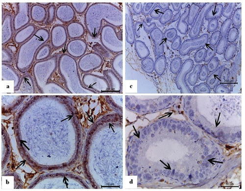 Figure 8. Photomicrographs of epididymal sections of normal and quinestrol-treated males of Nile rats showing immunohistochemical assays with immunolocalization of nuclear (Wt-1) antibody. Normal males: (a) and (b) show an exclusively strong nuclear Wt-1 immunoreaction in the epididymal ducts. (b) a magnified photo showed that Wt-1 mainly localized at the basement membrane (thin arrow), germinal cells (thick arrow), and intertubular space (IT). Quinestrol-treated males: (c) and (d) show a weak Wt-1 immunoreaction (arrows). (d) showed a magnified photo of the number of tubules with weak reaction in destructed germinal cells (thick arrow), basement membrane (thin arrow), and nearby no reaction in intertubular spaces (IT).