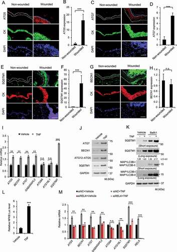 Figure 8. TNF induces keratinocyte autophagy through NFKB activation. (A-H) Immunofluorescence analysis of, ATG5 (A-B), ATG7 (C-D), SQSTM1 (E-F), and BECN1 (G-H) in keratinocytes in non-wounded and wounded skin on day 2 post-wounding. Cytokeratin (CK) was used as a keratinocyte marker. The dotted line indicates CK-positive keratinocytes. Scale bar: 50 μm. All bars represent mean ± SD (n = 10). (I) Real-time PCR analysis for ATG5, BECN1, ATG7, GABARAPL2, ATG9, ATG16L1, and SQSTM1 mRNA level in NHEK cells, starved with 5 fold-diluted the defined medium for NHEK for 24 h, then treated with or without TNF (100 ng/ml) for 18 h. Data are shown as mean ± S.E. (n ≥ 3). (J) Immunoblot assay for ATG5, ATG7, BECN1, and SQSTM1 protein level in NHEK cells, starved with 5 fold-diluted the complete medium for NHEK for 24 h, treated with or without TNF (100 ng/ml) for 18 h. (K) Immunoblot assay for MAP1LC3B-I/II, SQSTM1, and GAPDH (glyceraldehyde-3-phosphate dehydrogenase) in NHEK cells, starved with 5 fold-diluted the complete medium for NHEK, then treated with or without the lysosome inhibitor bafilomycin A1 (BafA1, 25 nM), and treatment of TNF (100 ng/ml) for 18 h. (L) Luciferase reporter analysis of NFKB response element in NHEK cells treated with or without TNF (100 ng/ml) for 18 h. (M) Real-time PCR analysis for ATG5, BECN1, ATG7, GABARAPL2, ATG9, ATG16L1, and SQSTM1 mRNA level in NHEK cells transfected with siNC or siRELA, starved with 5 fold-diluted the defined medium for NHEK for 24 h, then treated with or without TNF (100 ng/ml) for 18 h. Data are shown as mean ± S.E. (n ≥ 3). *, P < 0.05; **, P < 0.01; ***, P < 0.001; Results were obtained from at least three independent experiments