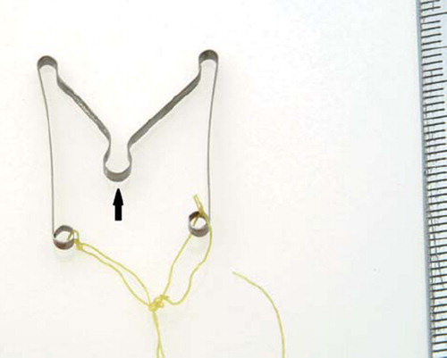 Figure 1. The M-211 intrauterine contraceptive device. (Courtesy of Museum of Contraception and Abortion (MUVS), Vienna.)