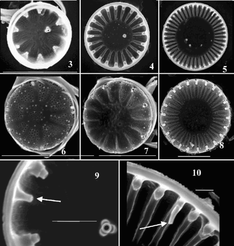 Figs 3–10. Scanning electron micrographs of valves from Cyclotella meneghiniana cultures. Figs 3–5. Valve interiors. Figs 6–8. Valve exteriors over the size range. Figs 9–10, Detail of interior margins showing rimoportulae (arrows) in an extremely small (Fig. 9) and a larger (Fig. 10) valve. Scale bars represent 5 µm (Figs 3–8) and 1 µm (Figs 9, 10).