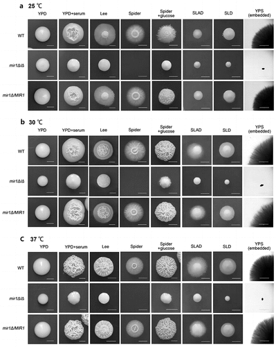 Figure 3. The mir1Δ/Δ mutant strain could not form hyphae on many kinds of media. Hyphal formation of Candida albicans wild-type, mir1Δ/Δ, and mir1Δ/MIR1 strains on different media at (a) 25 °C, (b) 30 °C, (c) 37 °C. Scale bars = 1 mm.
