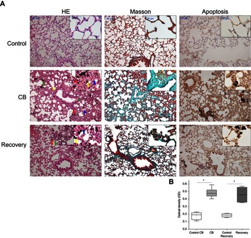 Figure 4 Representative histopathological images and the apoptosis of lung tissue in rats. (A) Representative histopathological images stained by HE and Masson as well as apoptosis by TUNEL. Inset: a higher magnification of the lung tissue (400×). The arrows indicate: Red arrow, CB particles in pulmonary alveoli or bronchiole; Yellow arrow, macrophages with CB particles; Blue arrow, granuloma; Green arrow, alveolar walls and pulmonary mesenchyme thickened; Red triangle, inflammatory cells; Yellow triangle, alveolar fusion. Blue triangle, serous inflammation; Green triangle, abnormal endotracheal mucosal epithelial cells. (B) Apoptosis levels in the lung of rats induced by CB. *P<0.05 compared with the control group. #P<0.05 compared with the CB exposure group. Data were shown as the mean ± SD. n=6.